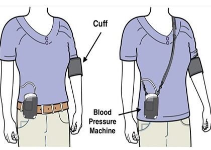 bp-monitoring