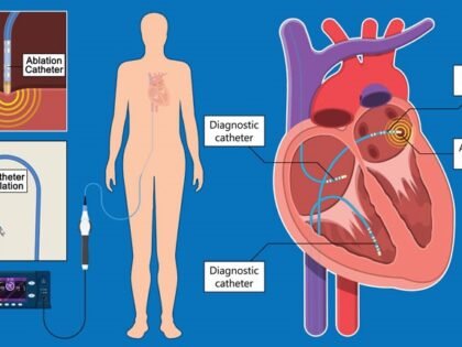 electrophysiology
