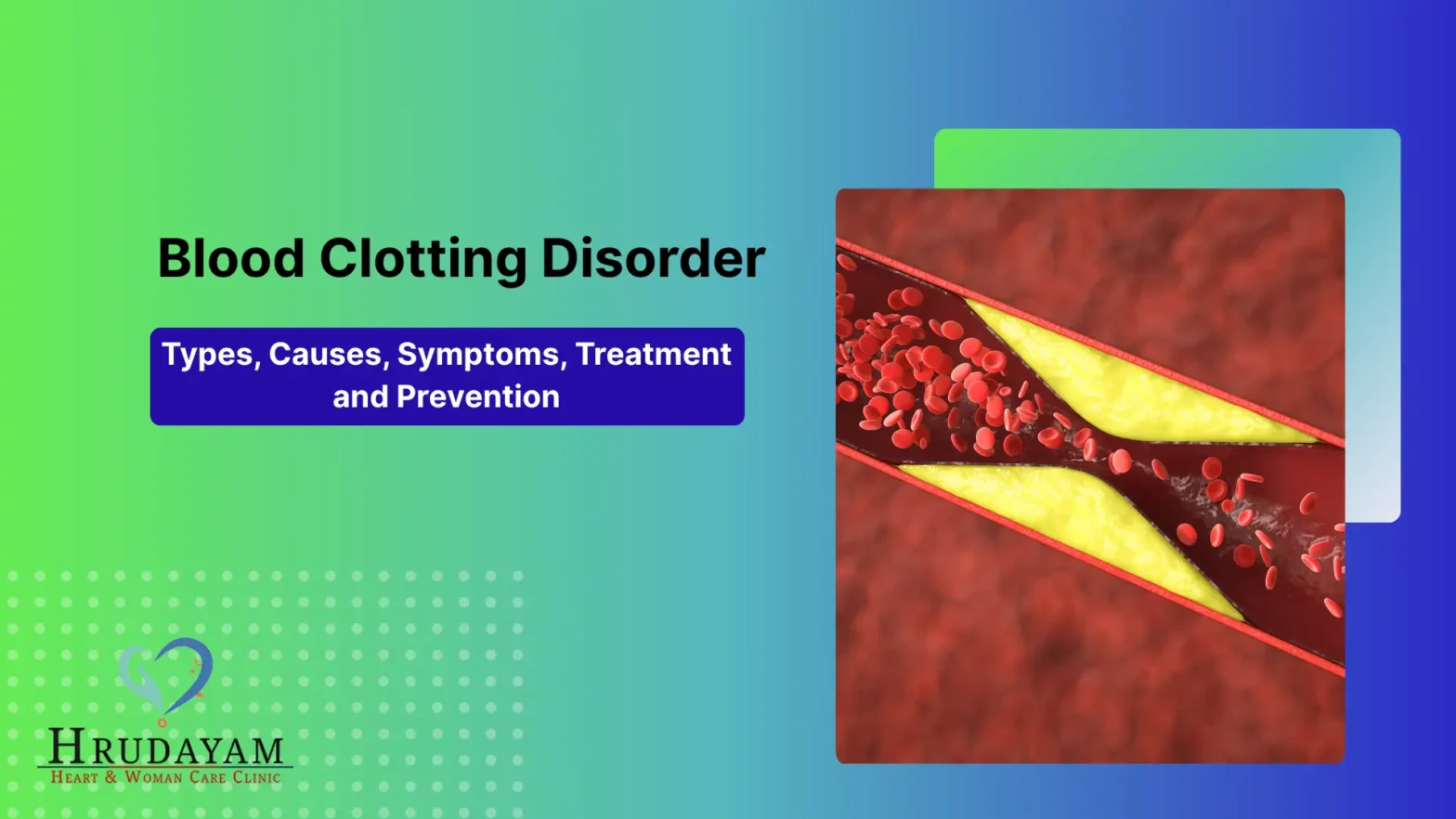 Blood Clotting Disorder: Types, Causes, Symptoms, Treatment and Prevention