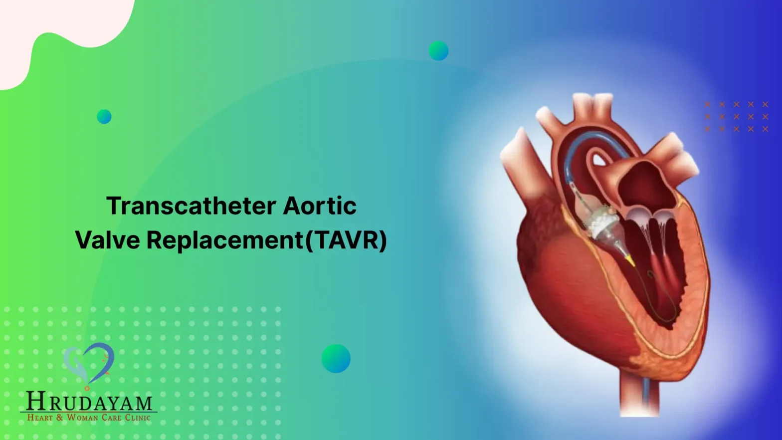 Transcatheter Aortic Valve Replacement (TAVR): Procedure, Benefits & Complications